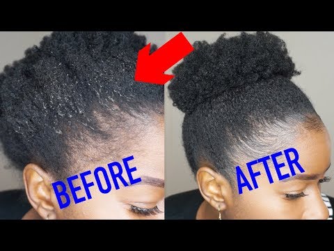 How to Get Rid of GEL FLAKING on Natural Hair!!!| Mona B. How to Get Rid of GEL FLAKING on Natural Hair!!!| Mona B.
