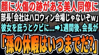 【感動する話】火事で顔に火傷を負った美人社員に部長が「お前の顔は見たくないｗバケモノは来るなｗ」俺「部長やめてください！」→彼女を庇ったらクビに   →１週間後、会長「私の孫はどこへ？」 【朗