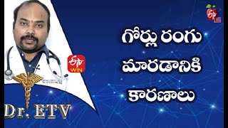 Cause ForNails To Change Color| గోర్లు రంగు మారడానికి కారణాలు| Dr.ETV | 28th October 2021 | ETV Life