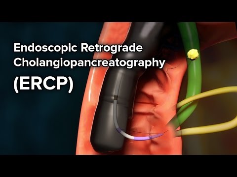 What does the word cholangiopancreatography mean?