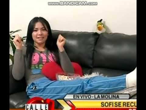 Clip 426 Broken Leg Cast Slc Youtube Clip 426 Broken Leg Cast Slc Youtube