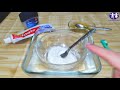 In just 2 Minutes - Turn Yellow Teeth to Pearl White With This Kitchen Ingredients amazing Teeth
