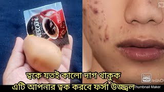 ৪০ পেরলেও জেল্লা দেবে ত্বক,  এই দুইটা জিনিস এভাবে লাগান ত্বক হবে ফর্সা টানটান। ৪০ সে দেখাবে ১৮ এর মত