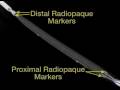 Bolton Relay Thoracic Stent Overview Video