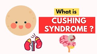 Understanding Cushing Syndrome: Symptoms, Causes, and Treatment Explained