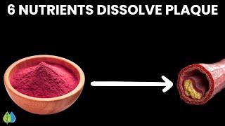 6 Natural Nutrients That Dissolve Arterial Plaque