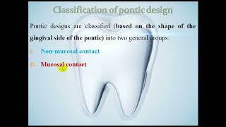 Pontics part 1