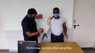 Make in India  Prosthetic Arm Developed by Solbots Technologies