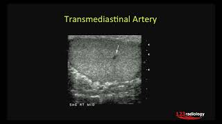 36  Basic Sonographic Anatomy of the Testis