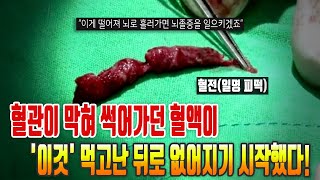 혈관이 막혀 썩어가던 혈액이 '이것' 먹고난 뒤로 없어지기 시작했다!