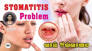 ஒவ்வாமையால் வரும் வாய் அலர்ஜி | Stomatitis Problem Treatment / #stomatitis #maduraihomeopathy