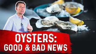 Are Oysters Good For You? – Dr. Berg