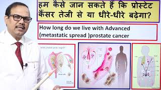Survival in advance prostate cancer. Dr.(Prof)Santosh Kumar PGI