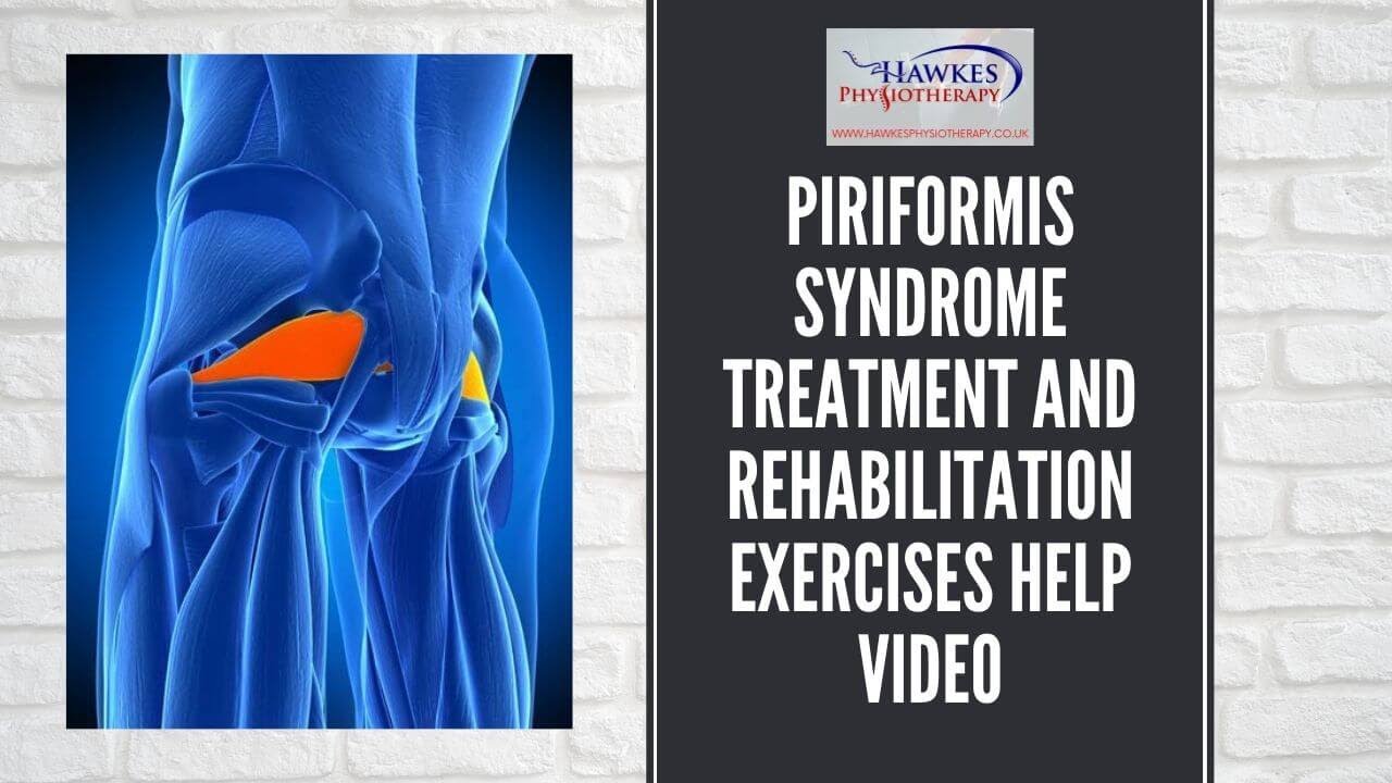 Piriformis Syndrome Rehabilitation Exercises Infographic Nbkomputer