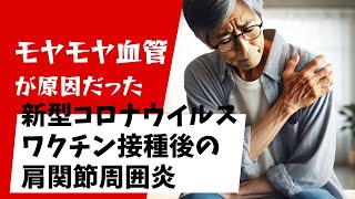 キャッスルマン病患者に生じた新型コロナウイルスワクチン接種後の肩関節周囲炎（SIRVA、キャッスルマン病、肩関節周囲炎）