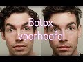 Botox voorhoofd | Furrow.nl