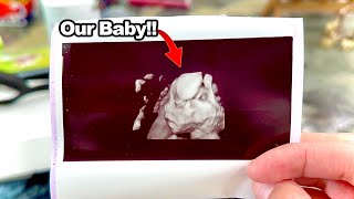 Seeing our baby's face