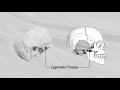 TEMPORAL BONE 1