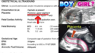 Pregnancy Scan Report at 20 Weeks 1 Day | Posterior Placenta Boy or Girl? | FHR 153bpm