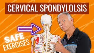 Cervical Spondylosis (DJD)—NEVER DO THIS, DO This Protocol for safe relief. (Over 50)
