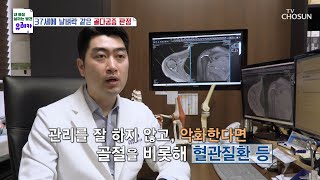 젊은 나이에 진단 받으면 더욱 위험한 골다공증 TV CHOSUN 230409 방송  | [내 몸을 살리는 발견 유레카] 109회 | TV조선