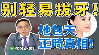 正畸医生提醒，地包天牙齿矫正千万别拔牙！