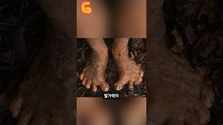 신발을 안 신으면 생기는 신체변화