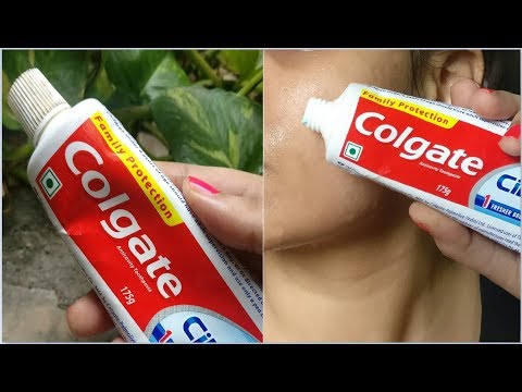 i Apply Toothpaste on my skin & look what happened, Toothpaste Beauty Hacks for Black heads, Acne i Apply Toothpaste on my skin & look what happened, Toothpaste Beauty Hacks for Black heads, Acne