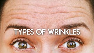 Types of Wrinkles
