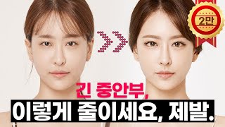 양악수술 없이 긴 중안부, 긴 얼굴 커버하는 성형수술/시술 알고싶은사람?🙋성형외과 전문의 닥터 눈코익이 알려드려요🎓