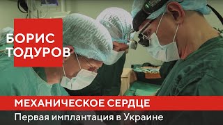 Первая в Украине имплантация механического сердца | Борис Тодуров ► Институт Сердца 12.07.2016