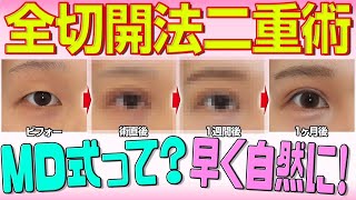 【二重整形】厚いまぶたでも取れない二重術は切開がおすすめ！術後注意点を解説【湘南美容クリニック】