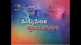 ముక్కు నుంచి రక్తం కారుతోందా?| సుఖీభవ | 02 మార్చి 2020| ఈటీవీ తెలంగాణ