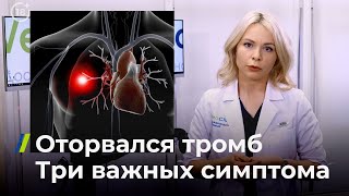 Оторвался тромб: три важных симптома