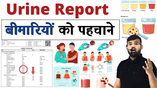 Urine Report | बीमारियां को पहचाने | Medicine  | Treatment | Doctor | Hospital | Medical | MBBS