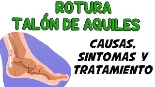 ROTURA DEL TALÓN DE AQUILES,  Causas, signos y síntomas, diagnóstico y tratamiento