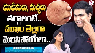 మొటిమలు, మచ్చలు తగ్గాలంటే | Remove Pimples and Acne Scars | Vernon Skin \u0026 Hair Clinic