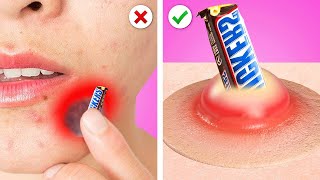 11 Ways To SNEAK FOOD INTO HOSPITAL || Funny Food Sneaking Ideas & Ways to Sneak Candies by Kaboom!