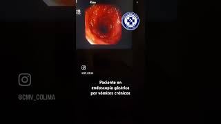 Endoscopia exploratoria para toma de biopsia en mascota con problemas crónicos de vómitos #endoscopy