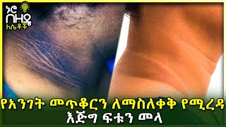 Ethiopia : የአንገት መጥቆርን ለማስለቀቅ የሚረዳ እጅግ ፍቱን መላ