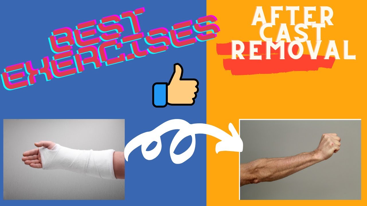 Broken Wrist Exercises Broken Finger Or Broken Thumb Symptoms