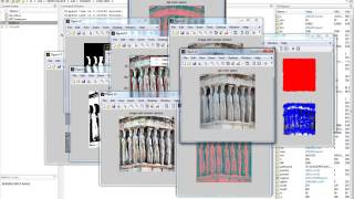 Image Forgery Detection Using Adaptive Over-Segmentation and Feature Point Matching|Matlab Projects