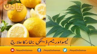 Limo aur neem se dengue bukhar ka ilaj | SAMAA TV