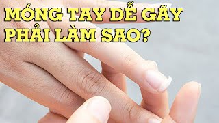 Cách chăm sóc móng tay yếu dễ gãy đơn giản tại nhà - Mẹo Vặt Cuộc Sống