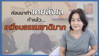 ก่อนมาทำเคยลังเล...ทำไปแล้วมั่นใจเหมือนธรรมชาติมาก | รีวิวคนไข้รากฟันเทียม คุณหมอกานต์ Dentalimage