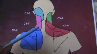 Cervical Medial Branch Blocks