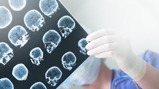 No Link Found Between Traumatic Brain Injury and Cognitive Decline