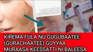 KIREMA FULA NU GUGUBAATEE (GURACHAATEE) GUYYAA MURAASA KEESSATTI NI BALEESA