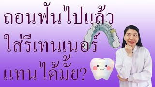 ถอนฟันไปแล้วใส่รีเทนเนอร์แทนได้มั้ย