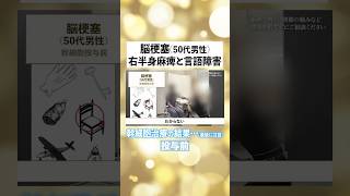 右半身麻痺・言語障害の50代男性｜幹細胞治療を行った結果【脳梗塞 再生医療】